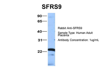 SFRS9 Rabbit Polyclonal Antibody