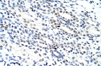 NOL4 Rabbit Polyclonal Antibody