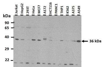 EIF2S1 Rabbit Polyclonal Antibody