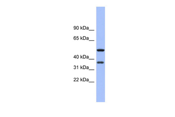 EIF2S1 Rabbit Polyclonal Antibody