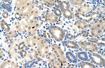 EIF2S1 Rabbit Polyclonal Antibody