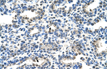 EIF2S1 Rabbit Polyclonal Antibody