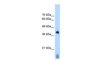 EIF2S1 Rabbit Polyclonal Antibody