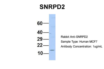 SNRPD2 Rabbit Polyclonal Antibody