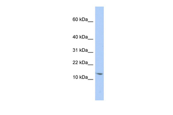 SNRPD2 Rabbit Polyclonal Antibody