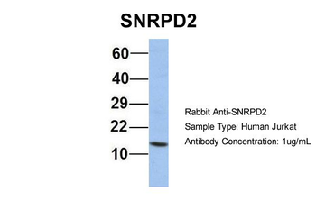 SNRPD2 Rabbit Polyclonal Antibody