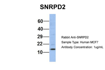 SNRPD2 Rabbit Polyclonal Antibody