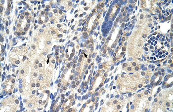 EIF4E2 Rabbit Polyclonal Antibody