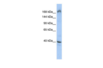 EIF4G1 Rabbit Polyclonal Antibody