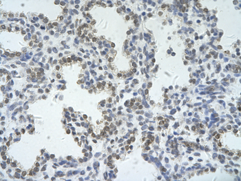 ZRSR2 Rabbit Polyclonal Antibody