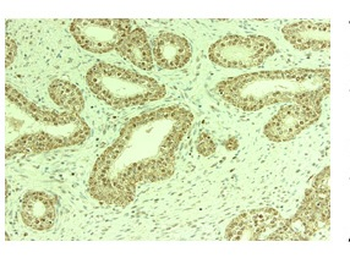 THOC1 Rabbit Polyclonal Antibody