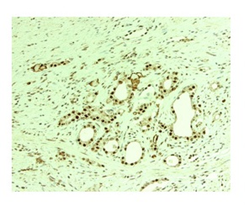 THOC1 Rabbit Polyclonal Antibody
