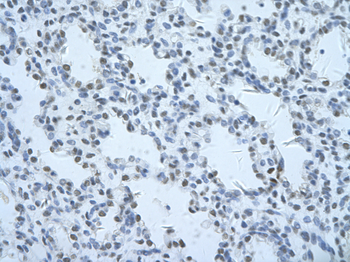 THOC1 Rabbit Polyclonal Antibody
