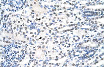THOC1 Rabbit Polyclonal Antibody
