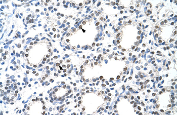 THOC1 Rabbit Polyclonal Antibody