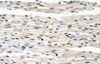 HNRNPDL Rabbit Polyclonal Antibody