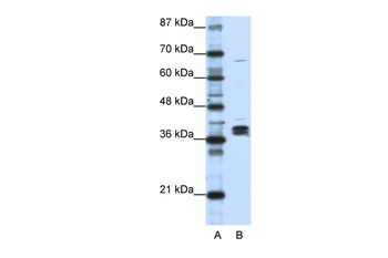 HNRNPDL Rabbit Polyclonal Antibody