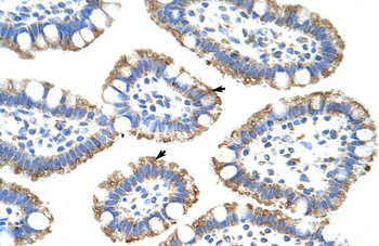 SF3B4 Rabbit Polyclonal Antibody