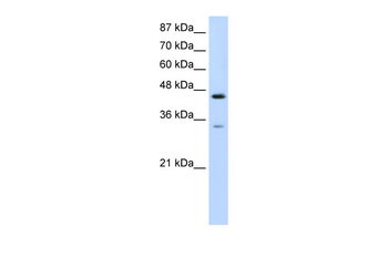 SF3B4 Rabbit Polyclonal Antibody