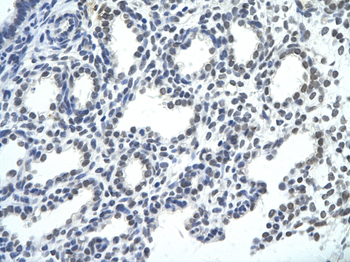 SMNDC1 Rabbit Polyclonal Antibody