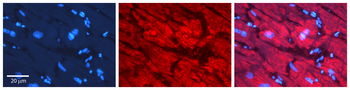 NXF1 Rabbit Polyclonal Antibody