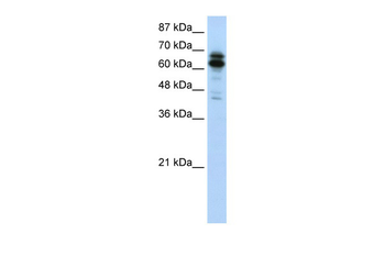SYNCRIP Rabbit Polyclonal Antibody