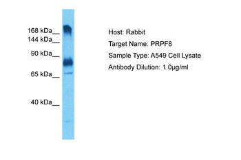 PRPF8 Rabbit Polyclonal Antibody