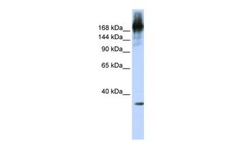 PRPF8 Rabbit Polyclonal Antibody