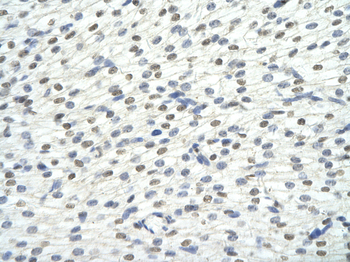 KHDRBS1 Rabbit Polyclonal Antibody