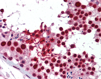 KHDRBS1 Rabbit Polyclonal Antibody