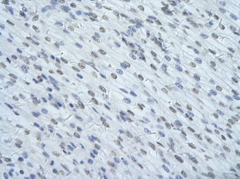 HNRPUL1 Rabbit Polyclonal Antibody