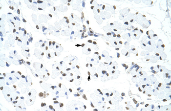 HNRPUL1 Rabbit Polyclonal Antibody