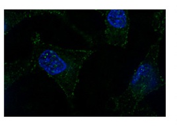 NONO Rabbit Polyclonal Antibody