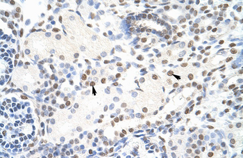 NONO Rabbit Polyclonal Antibody