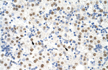 NONO Rabbit Polyclonal Antibody