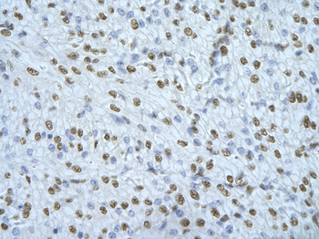 NONO Rabbit Polyclonal Antibody