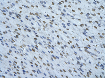NONO Rabbit Polyclonal Antibody