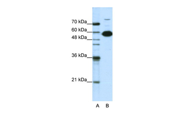 NONO Rabbit Polyclonal Antibody