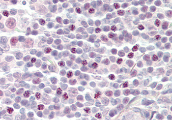 SF3B3 Rabbit Polyclonal Antibody