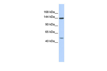 SF3B1 Rabbit Polyclonal Antibody