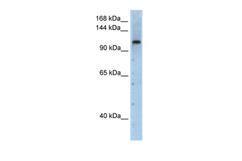 PRPF6 Rabbit Polyclonal Antibody