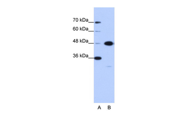 GTPBP9 Rabbit Polyclonal Antibody