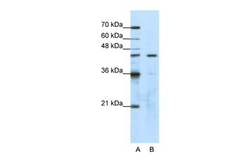 GTPBP9 Rabbit Polyclonal Antibody