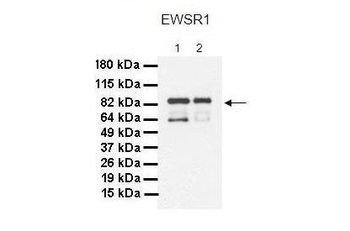 EWSR1 Rabbit Polyclonal Antibody