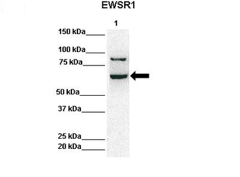 EWSR1 Rabbit Polyclonal Antibody