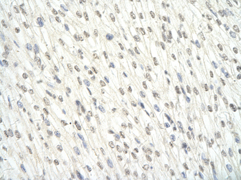 EWSR1 Rabbit Polyclonal Antibody