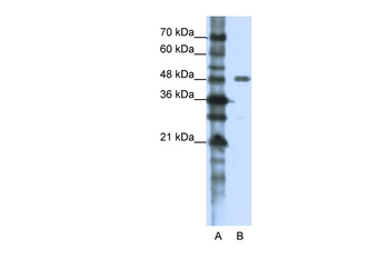 PPP1R8 Rabbit Polyclonal Antibody