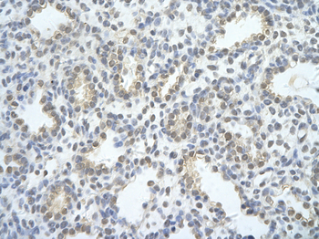 EXOSC2 Rabbit Polyclonal Antibody