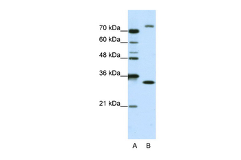 EXOSC2 Rabbit Polyclonal Antibody