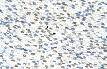 RBM22 Rabbit Polyclonal Antibody